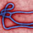 Ebola Virus