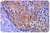 Troubleshoot Multiplex IHC with Confidence