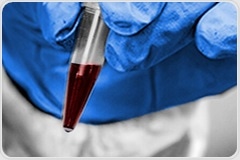 New How-To Series for Toxicology Method Development