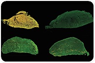A New Cas9 mRNA-Based Therapy Holds Promise to Treat Muscular Dystrophy