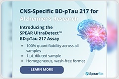 Brain-Derived Tau Improves Alzheimer’s Precision