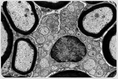 JEOL JEM-120i: Compact, Easy, Expandable TEM