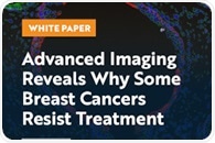 Advanced Imaging Reveals Why Some Breast Cancers Resist Treatment