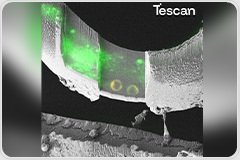 Tailored Cryo-EM and Correlative Workflows for Challenging Biological Samples