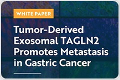 Tumor-Derived Exosomal TAGLN2 Promotes Metastasis in Gastric Cancer