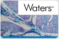 [Free Webinar] Salivary Cortisone in the Investigation of Adrenal Disease by LC-MS/MS
