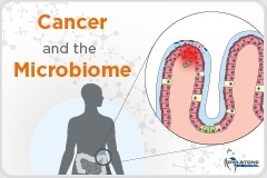 The intersection between cancer & the microbiome