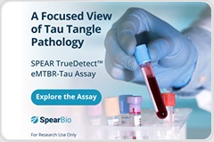 Measuring Tau Tangle Pathology in Blood