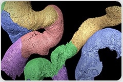 3D Imaging Advances Study of Glomerular Diseases