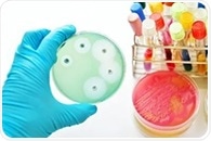 Microbiology and the zone of inhibition