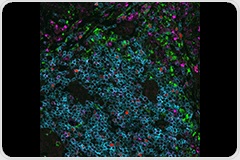 Discover Spatial Multiomics for Deeper Genomic Insights