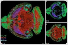 Whole-Brain Imaging of Alzheimer’s Plaques