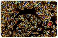 Quantitative Analysis of Cultured Cells: Case Study