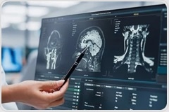 How innovation in dried blood spot testing is transforming neurological disease monitoring