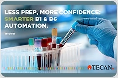 See how to automate B1 & B6 with fewer resources