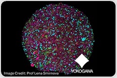 Advancing Neuroscience with High-Content Imaging