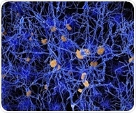Neuronal loss very limited in Alzheimer's disease, new study shows
