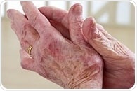 Women with rheumatoid arthritis suffer greater decline in physical function after menopause