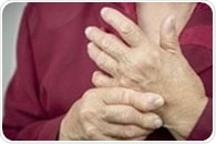 Rheumatoid arthritis found to worsen during and after menopause, study says