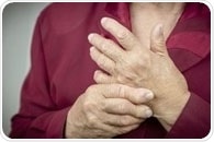 Rheumatoid arthritis found to worsen during and after menopause, study says