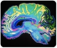 Excitatory magnetic brain stimulation reduces emotional arousal to fearful faces, study shows