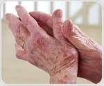 Studies find alarming shortage of rheumatology workforce in future