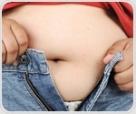 New analysis shows upward trend in childhood obesity