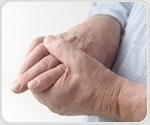 Gout medication may help improve heart function in adult patients