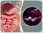 Campylobacteriosis Symptoms