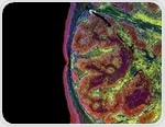 Scientists develop futuristic gene therapy for liver cancer