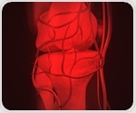Weight loss after lap-band surgery alleviates arthritic knee pain