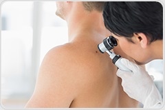 Study highlights impact of early detection on skin cancer survival