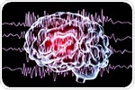 Study uncovers mechanism underlying brain malformation linked to severe epilepsy