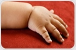 Study reveals risk factors involved in early onset and severity of obesity in children