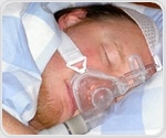 Researchers assess impact of sleep apnea treatment on diabetes management