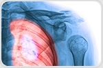 Phenotyping of Chronic Obstructive Pulmonary Disease (COPD)