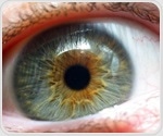 Study finds link between degenerative eye conditions and Alzheimer's disease