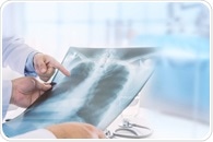 Lung Plethysmography Procedure