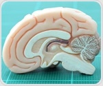 Golgi stress signaling pathway found in cells with Huntington’s disease