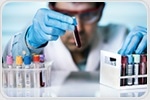 Study: Blood test can predict response of advanced prostate cancer patients to treatments