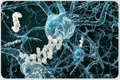 Researchers discover new information on pathological mechanisms of Alzheimer's disease