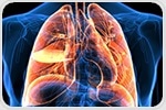 New project launched to map out lung cancer immunology