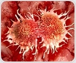 New potential immunotherapy target in pancreatic cancer identified