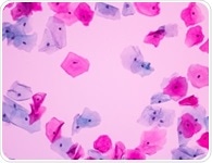 Developing a Cervical Cancer Test That’s 100% Predictive