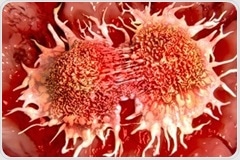 Study shows promise for future prostate cancer treatment