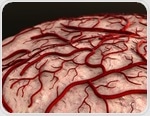 Blood-clotting factor may cause Alzheimer's disease