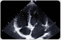 Cardiothoracic Imaging Techniques