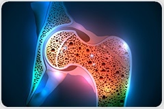 Study reveals new genes and biological pathways linked to osteoarthritis
