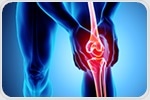First surgery in the U.S. to implant device for knee osteoarthritis