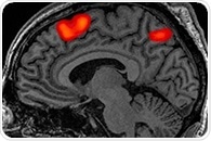 Lifetime adversity, increased neural processing during trauma combine to intensify core PTSD symptoms